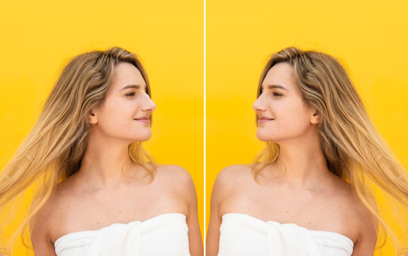 Pediatric Neuropsychology Before-After