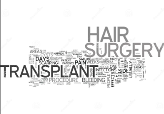 Hair Transplant